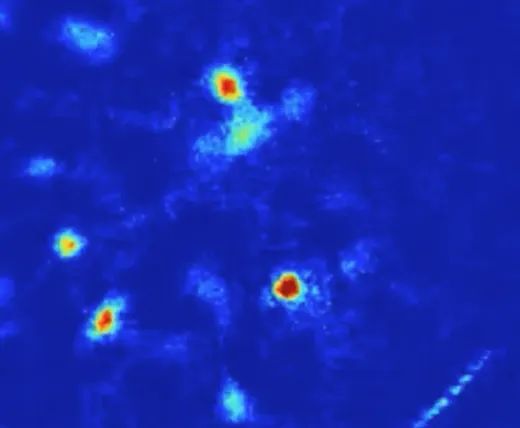 ‘Anxiety Cells’ Identified in the Brain’s Hippocampus
