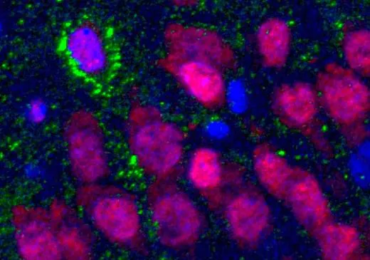 Even Old Brains Can Make New Neurons, Study Finds