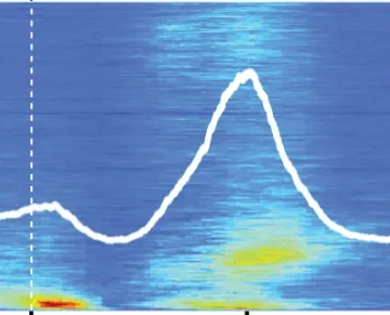 How the Brain Turns Down Volume