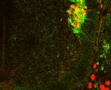 Pinpointing a Genetic Switch